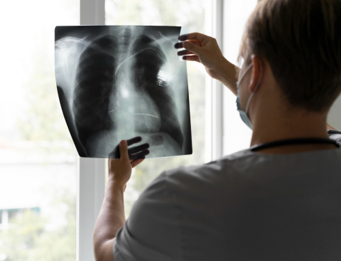 Рентген легких и грудной клетки в Казани - цены на рентгенографию взрослым и детям